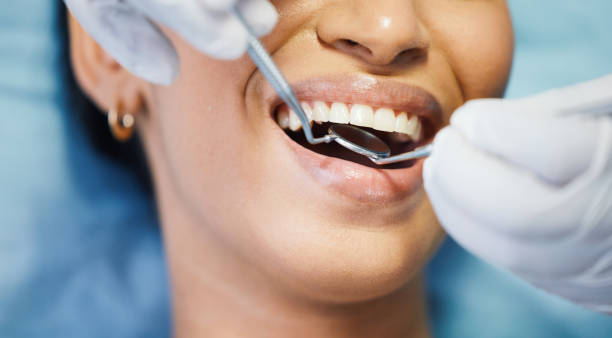 Best Knocked-Out Tooth (Avulsed Tooth) Treatment in Sugar Creek, MO